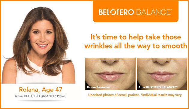 belotero-before-after-pics-faceplace